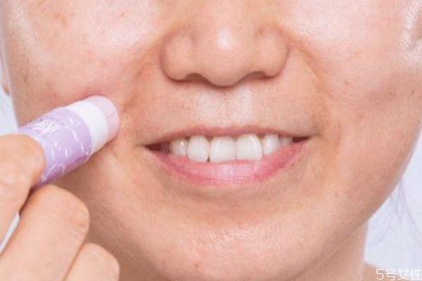 怎么去除嘴角皱纹 去除嘴角皱纹的方法 怎么去除嘴角皱纹 去除嘴角皱纹的方法
