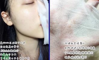 稚优泉面膜怎么用？稚优泉面膜要洗吗？