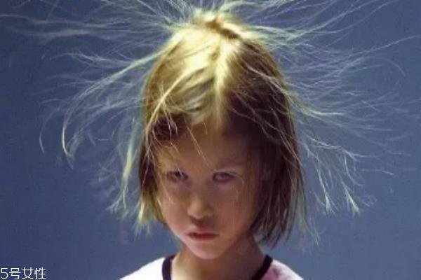 秋冬静电怎么办 这三招对症下药 秋冬静电怎么办 这三招对症下药